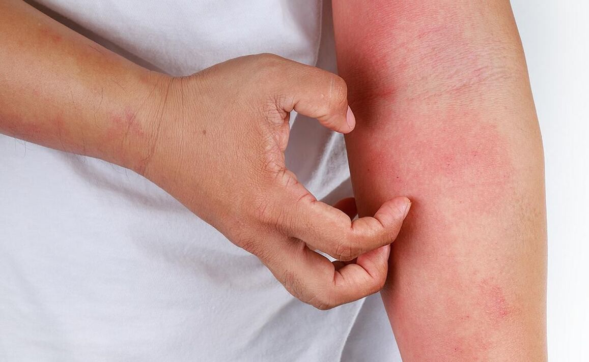 могуће компликације од употребе соде